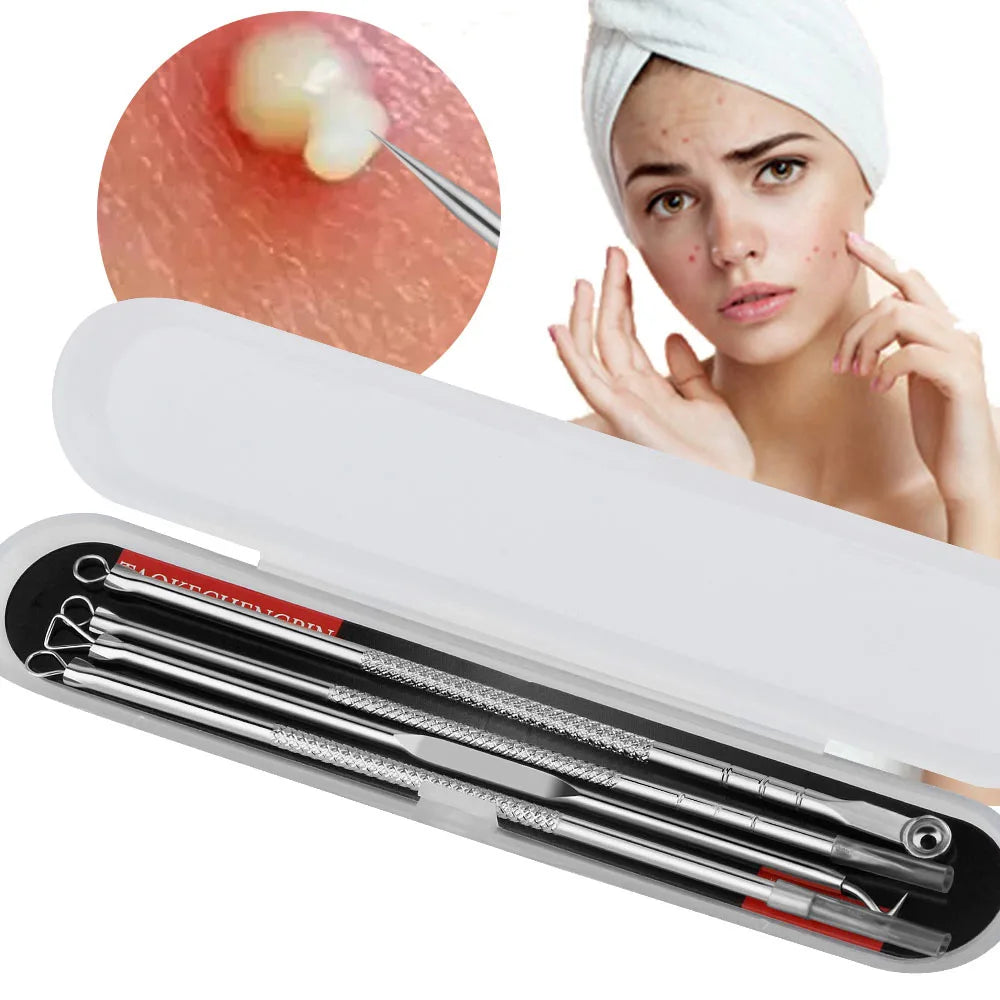 Needle Acne Removal