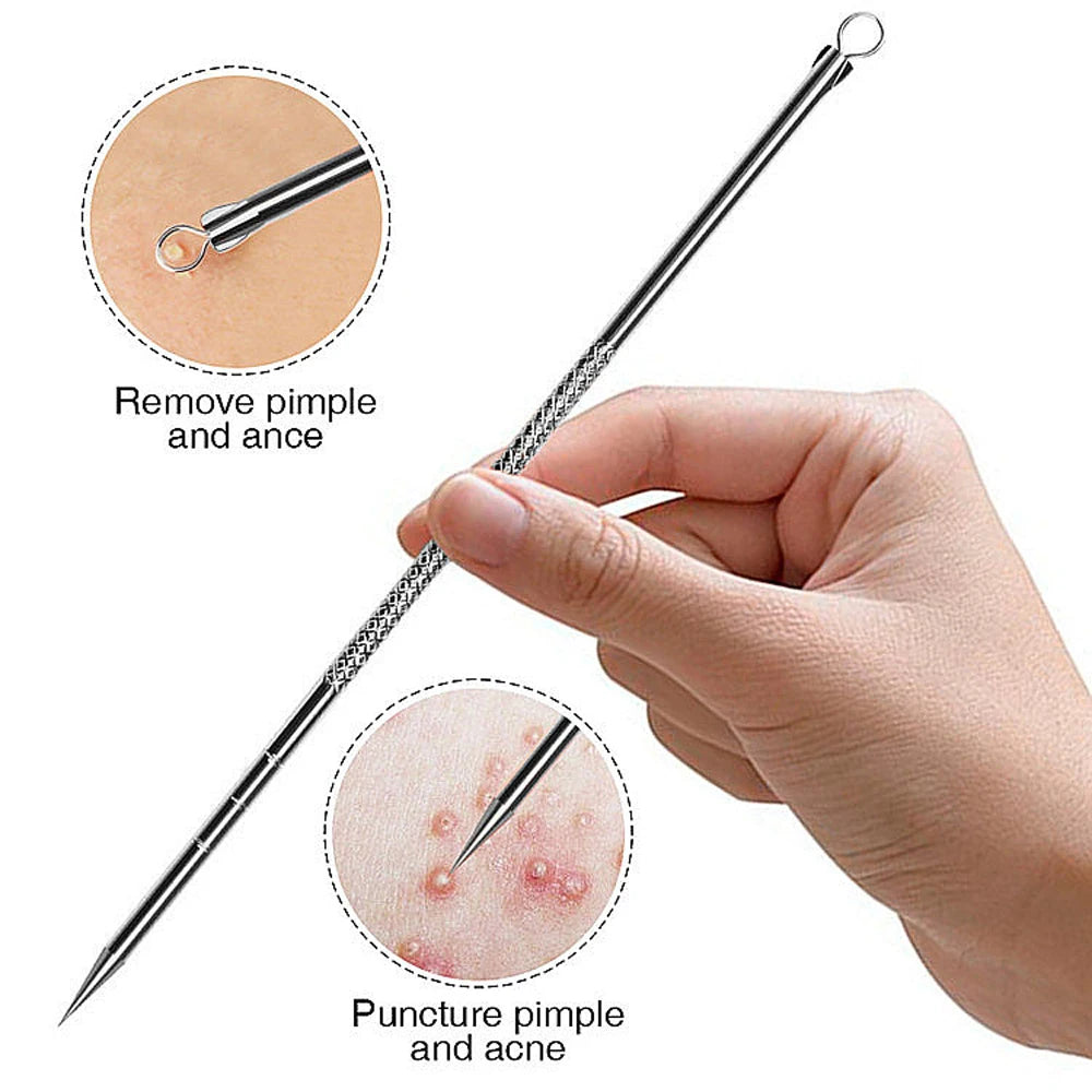 Needle Acne Removal